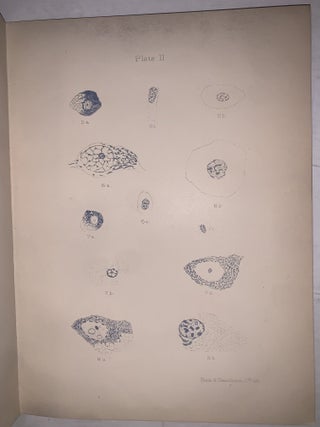 On the Metabolism and Action of Nerve Cells. Offprint from Brain: A Journal of Neurology.